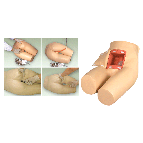 高級灌腸和輔助排便訓(xùn)練模型 高級灌腸和輔助排便訓(xùn)練模型