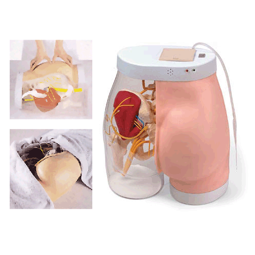 高級臀部肌肉注射訓練及對比模型(帶檢測警示系統(tǒng)) 高級臀部肌肉注射訓練及對比模型(帶檢測警示系統(tǒng))