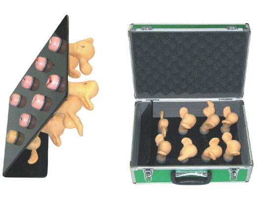 高級子宮宮頸病變模型(8件) 高級子宮宮頸病變模型(8件)