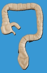 乙狀結腸鏡檢查模型 乙狀結腸鏡檢查模型