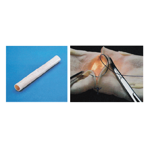 腸管吻合模型(20mm) 腸管吻合模型(20mm)