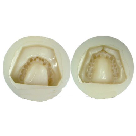 錯(cuò)頜畸形分類(lèi)演示陰模B 錯(cuò)頜畸形分類(lèi)演示陰模B