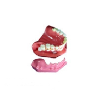 牙列發(fā)育模型A 牙列發(fā)育模型A