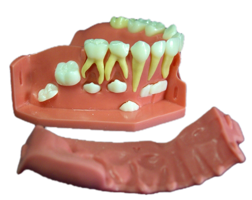 牙列發(fā)育模型B 牙列發(fā)育模型B