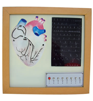心臟傳導(dǎo)系電動(dòng)模型 心臟傳導(dǎo)系電動(dòng)模型